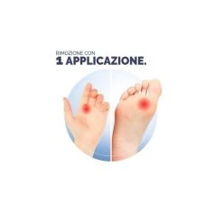 Dr Scholl Freeze Verruca Virus Spray Per Bambini 80ml 5 Dr Scholl Freeze Verruca Virus Spray Per Bambini 80ml -cleanser shop scholl freeze verruca virus spray per bambini 80ml 3 1632997668